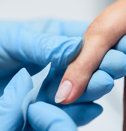 Dermatologist examining patient’s hand for warts