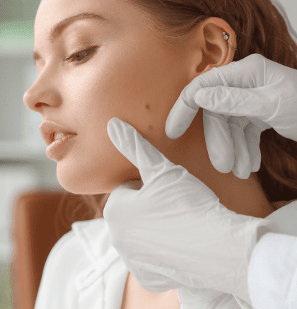 Dermatologist examining patient’s skin mole during consultation