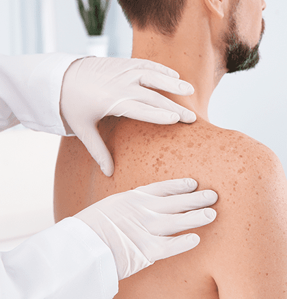 Dermatologist examining patient’s facial skin for hyperpigmentation