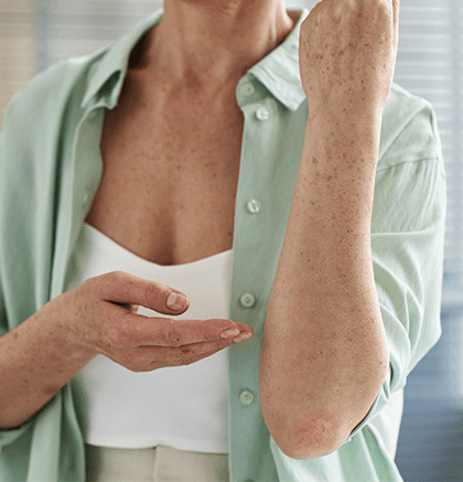 Dermatologist examining patient’s arm for keratosis pilaris