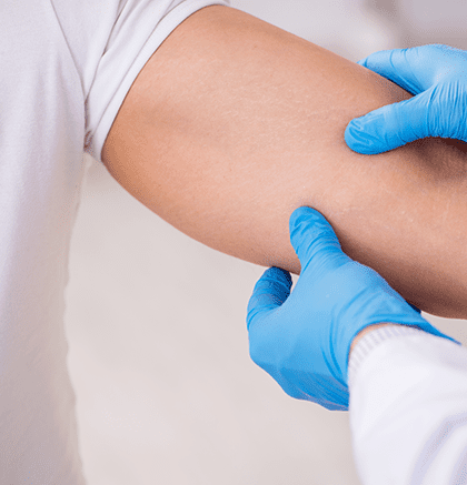 Dermatologist examining patient’s skin lump suspected to be a lipoma