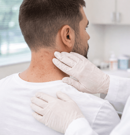 Close clinical exam of folliculitis on neck and upper back by dermatologist