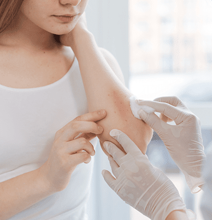 Dermatologist examining child’s skin for molluscum contagiosum