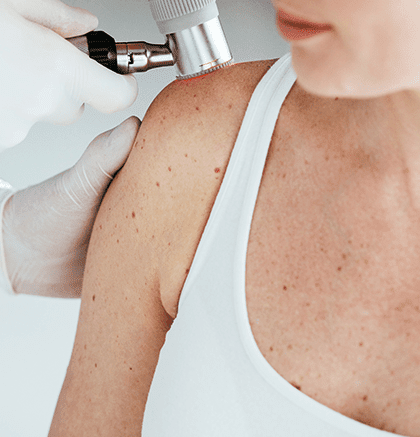 Dermatologist examining patient’s skin for seborrheic keratosis