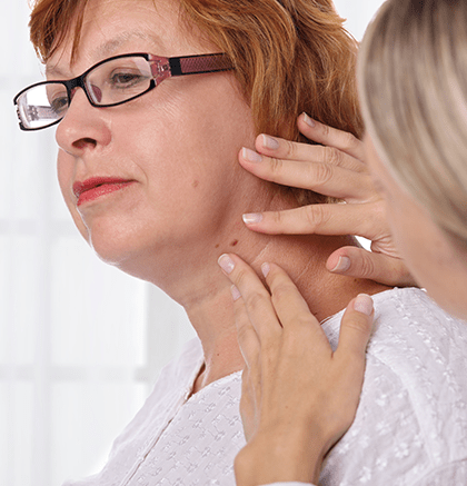 Dermatologist examining patient’s skin tag during consultation
