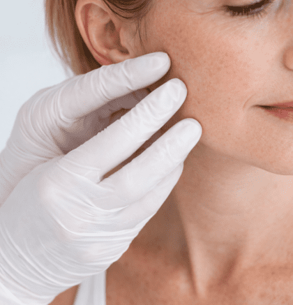 dermatologist examining facial skin for sebaceous hyperplasia